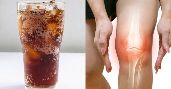 5 nhóm thực phẩm làm suy yếu hệ xương khớp nên tránh